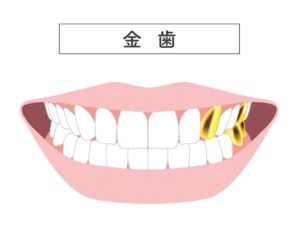 瑞穂市　歯医者　ホワイトニング開発物語　吉田歯科医院