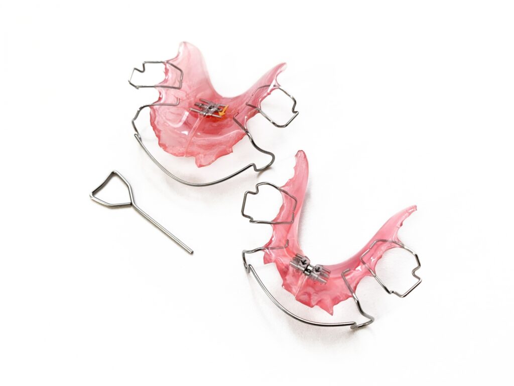 瑞穂市 歯医者 当院の矯正治療 吉田歯科医院