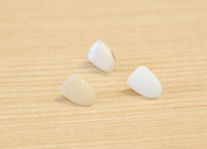 ジルコニア｜ホワイトエッセンス吉田