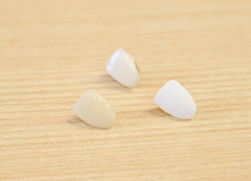 ジルコニア｜ホワイトエッセンス吉田