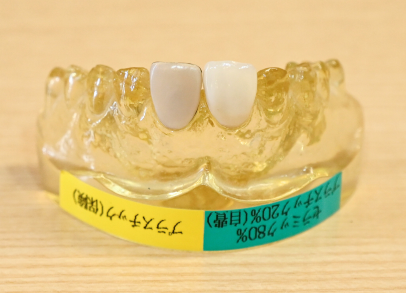 ハイブリッドセラミック｜ホワイトエッセンス吉田