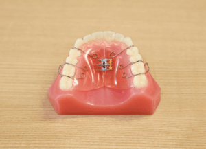 床矯正｜ホワイトエッセンス吉田