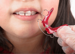 顎の成長発育を活用｜ホワイトエッセンス吉田