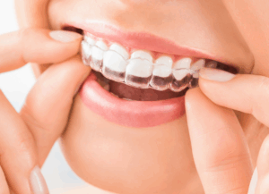 こんな方におすすめ｜ホワイトエッセンス吉田