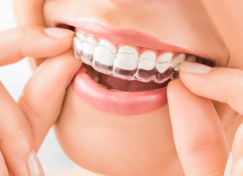 こんな方におすすめ｜ホワイトエッセンス吉田