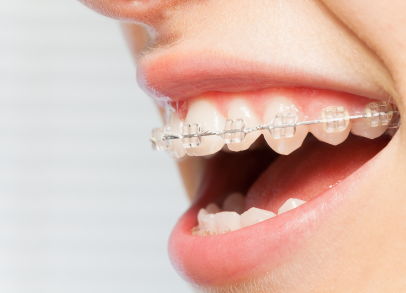 こんな方におすすめ｜ホワイトエッセンス吉田