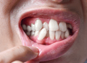 歯並びのこと、ひとりで悩んでいませんか？｜ホワイトエッセンス吉田