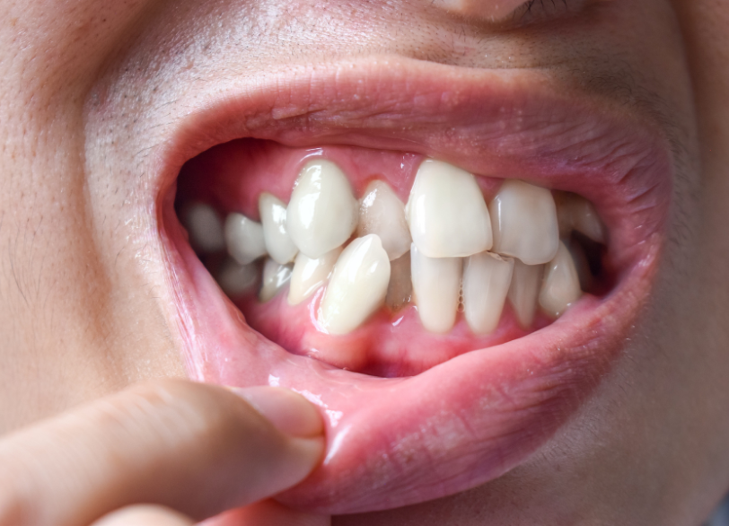 歯並びのこと、ひとりで悩んでいませんか？｜ホワイトエッセンス吉田
