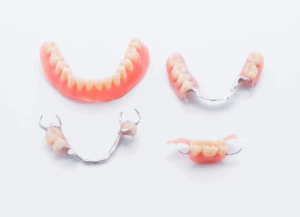 入れ歯メリット｜ホワイトエッセンス吉田