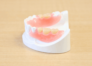 ノンクラスプ｜ホワイトエッセンス吉田