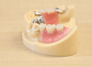 ホワイトクラスプ｜ホワイトエッセンス吉田