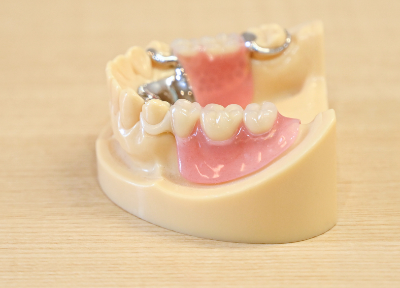 ホワイトクラスプ｜ホワイトエッセンス吉田