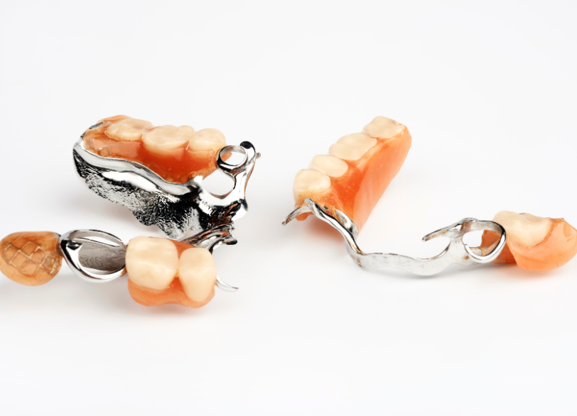 コバルトクロム金属床｜ホワイトエッセンス吉田