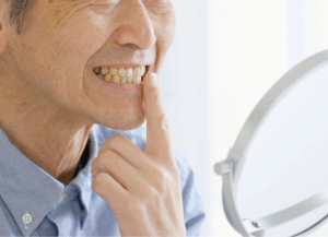 自分に合った入れ歯｜ホワイトエッセンス吉田