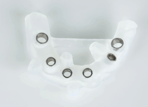 サージカルガイド｜ホワイトエッセンス吉田