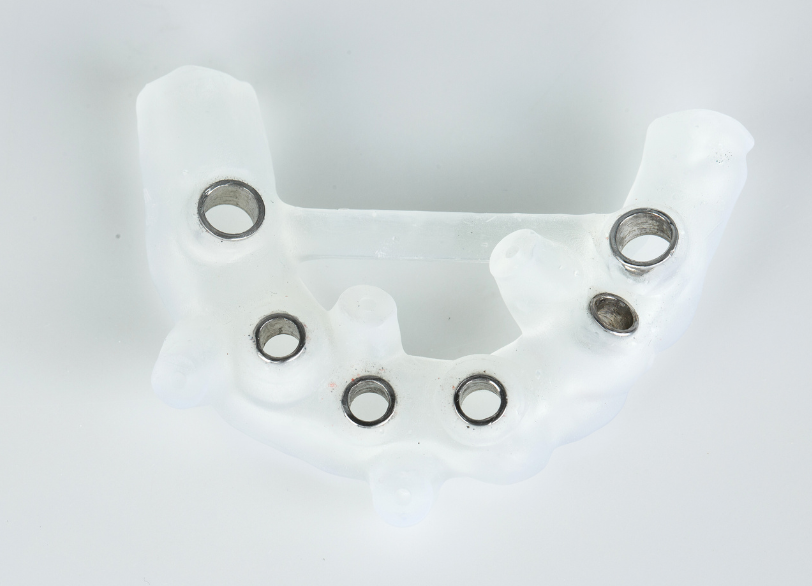 サージカルガイド｜ホワイトエッセンス吉田