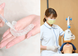 デュアルホワイトニング｜ホワイトエッセンス吉田