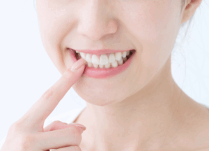 自信あふれる笑顔へ｜ホワイトエッセンス吉田