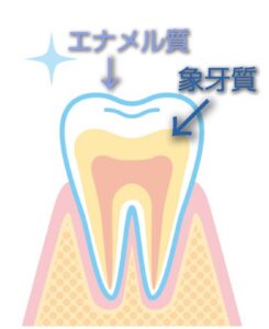 瑞穂市　歯医者　歯のホームホワイトニング　吉田歯科医院
