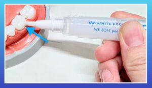 瑞穂市　歯医者　知覚過敏抑制剤　WE ソフト ペンタッチ　吉田歯科医院