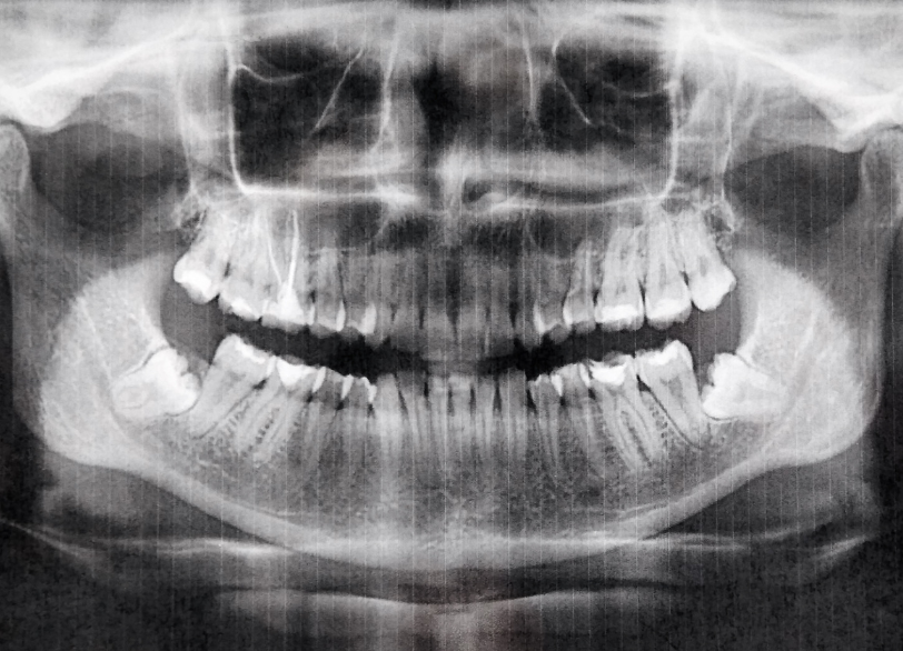 デジタルX線｜ホワイトエッセンス吉田