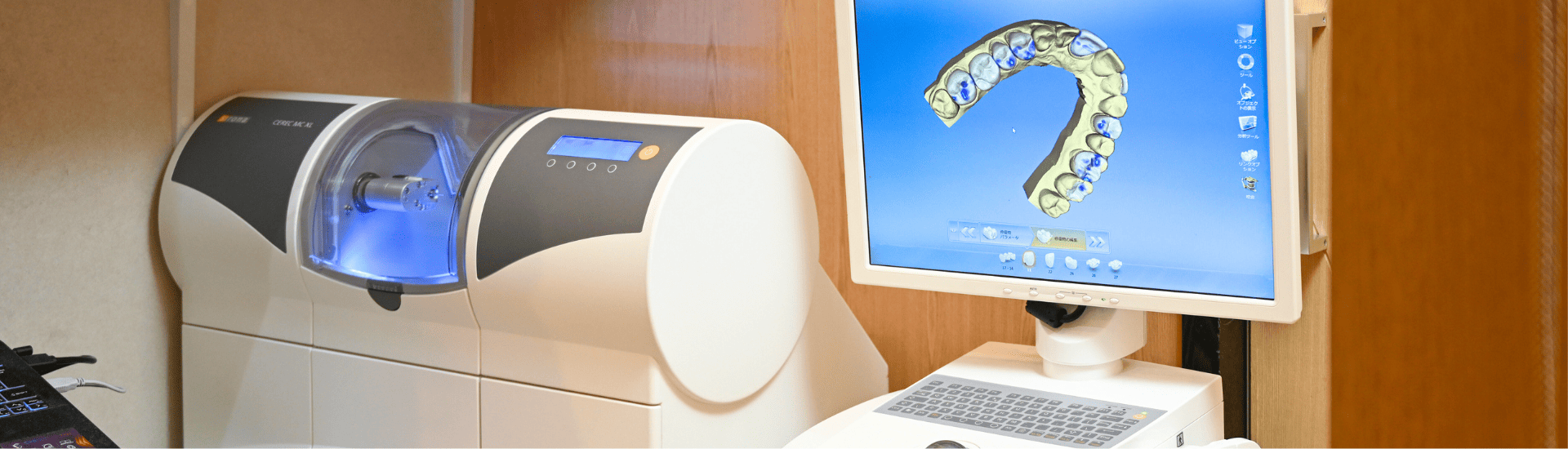 セレック治療｜ホワイトエッセンス吉田