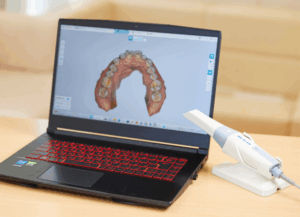 セレック治療で短期間でも美しく｜ホワイトエッセンス吉田