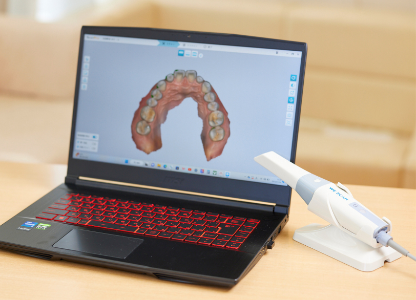 セレック治療で短期間でも美しく｜ホワイトエッセンス吉田