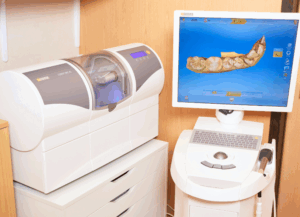 セレック｜ホワイトエッセンス吉田