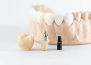 診療案内｜ホワイトエッセンス吉田