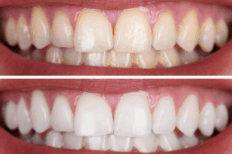 診療案内｜ホワイトエッセンス吉田