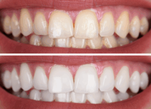 診療案内｜ホワイトエッセンス吉田