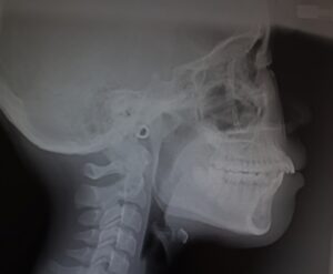 瑞穂市　歯医者　Eライン 　吉田歯科院