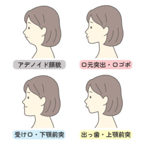 瑞穂市　歯医者　Eライン　吉田歯科医院